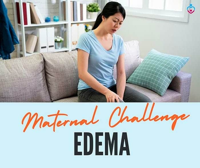 Edema Maternal Lactation Challenge