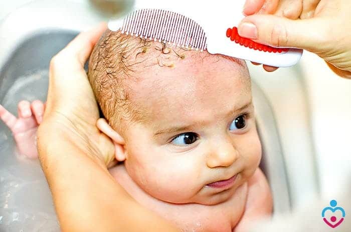 Can Breast Milk Help Cradle Cap?