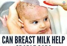 Can Breast Milk Help Cradle Cap?
