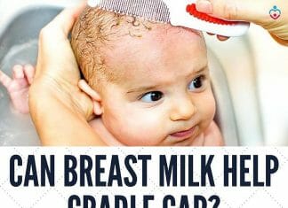 Can Breast Milk Help Cradle Cap?