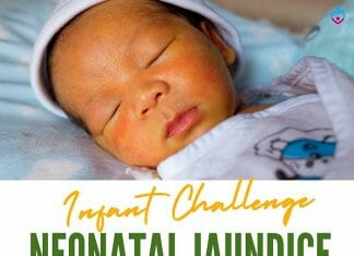 Neonatal Jaundice and breastfeeding