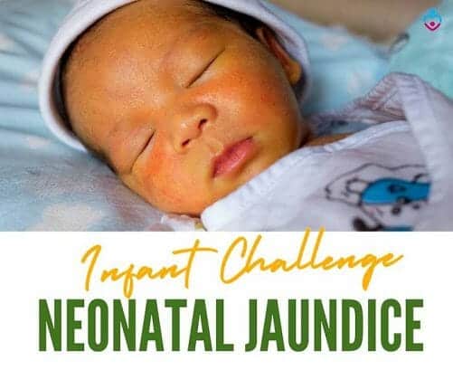 Neonatal Jaundice And Breastfeeding | Nursing Moms