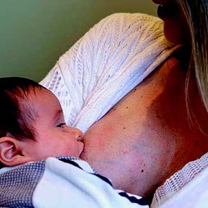 Why does breast engorgement occur?