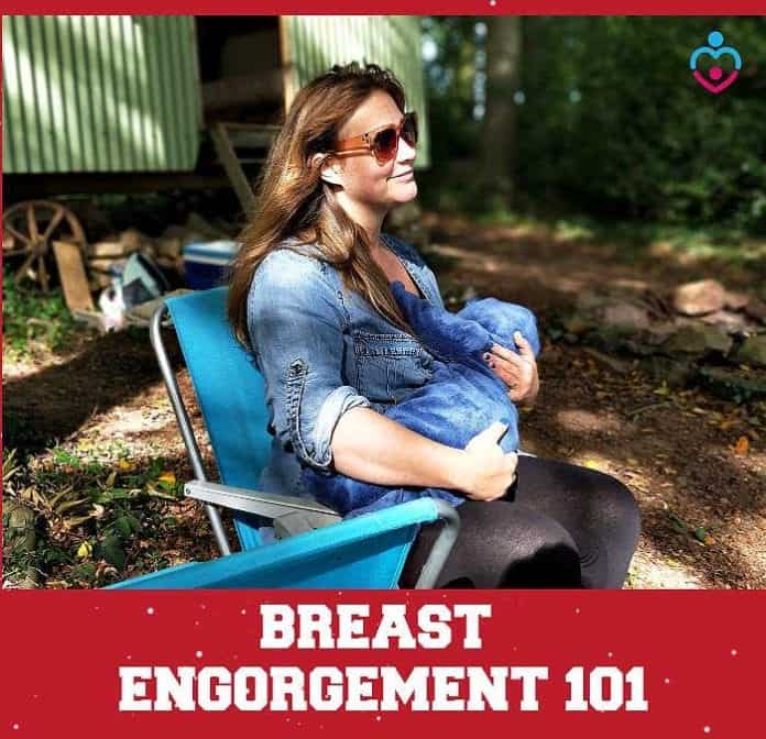 Breast Engorgement 101
