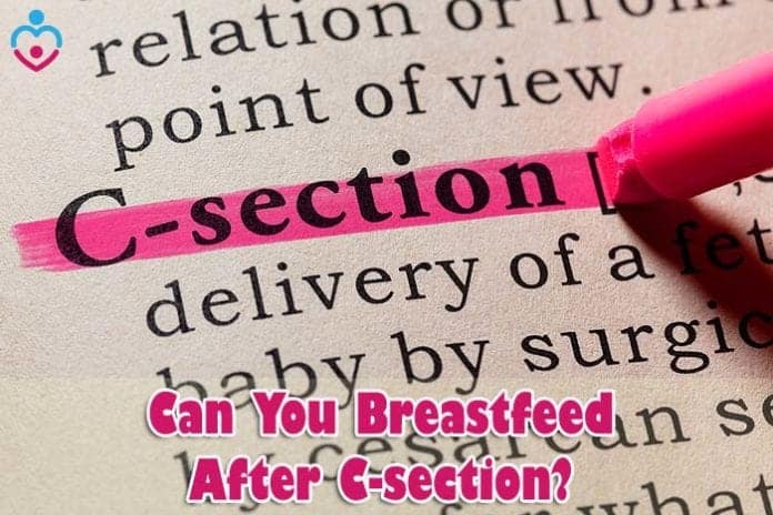 Can You Breastfeed After C Section?