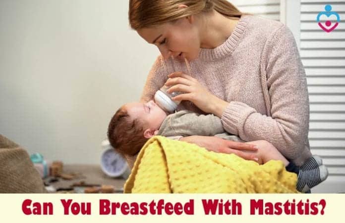 Can You Breastfeed With Mastitis?