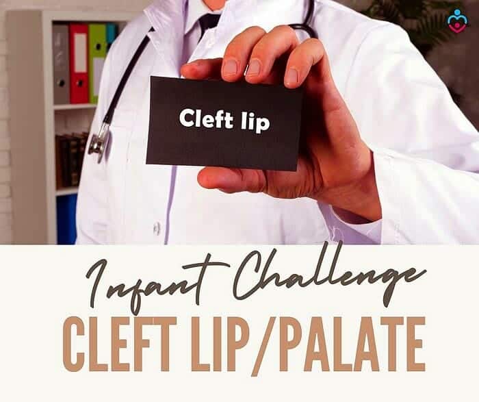 Cleft Lip (infant breastfeeding challenge)