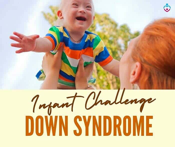Infant Breastfeeding Challenge with Down Syndrome